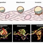 点亮希望！新技术有望探明胚胎移植失败原因